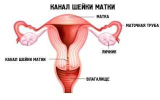 Симптомы воспаления цервикального канала