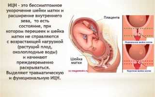 Лечение после конизации шейки матки