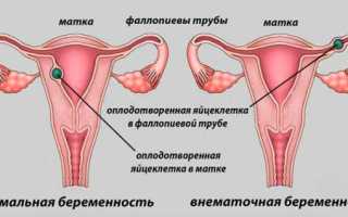 3 недели беременности