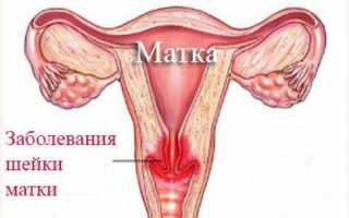Аспират эндометрия