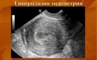 Как нарастить эндометрий для зачатия