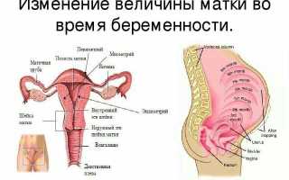 Высокое расположение матки