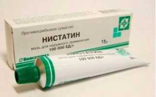 Мазь Нистатин при молочнице у женщин