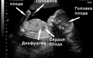 22 неделя беременности: тянет и болит живот, ощущения, выделения