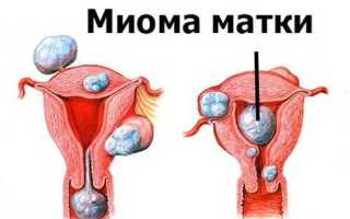 Почему кровит шейка матки