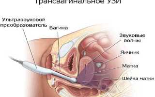 Когда лучше делать узи матки