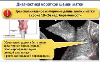 Как понять что шейка матки укорочена