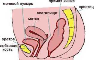Варикозное расширение вен матки