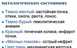 Как правильно сдавать мочу при беременности