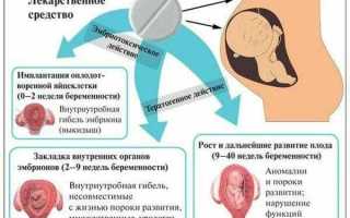 Чем лечить насморк при беременности