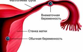 Восьмая неделя беременности