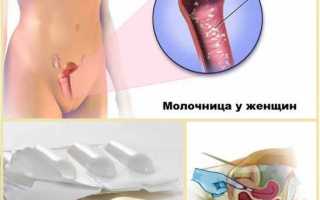 Миконазол при молочнице