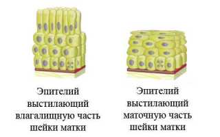 Эпителий шейки матки в норме