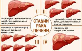 Онкология печени