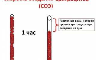 Что показывает СОЭ во время беременности и каковы показатели нормы
