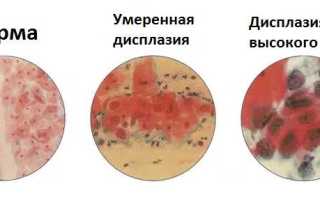 Что такое мазок на цитологию