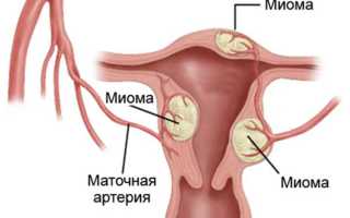 Обильные месячные со сгустками крови: возможные причины