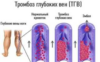 Жанин: отзывы и инструкция по применению