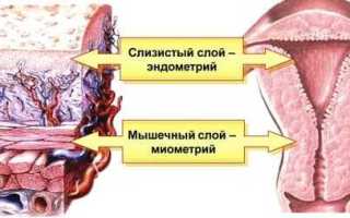 Что такое диффузно неоднородная структура миометрия