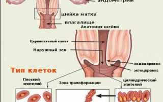 Лечение эрозии шейки матки при разных симптомах