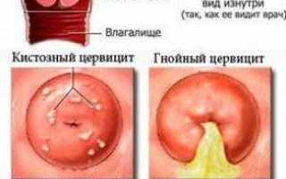 Пятна на шейке матки