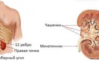 Рак почки МКБ 10