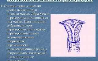 Удвоение шейки и матки