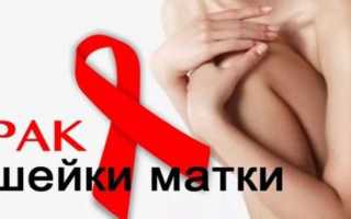 Как избежать рака шейки матки