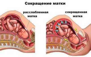 Пора или не пора: ложные схватки при беременности