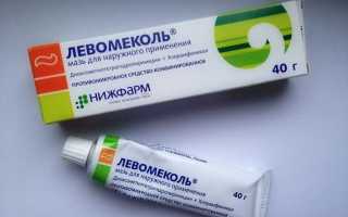 Помогает ли Левомеколь при баланопостите