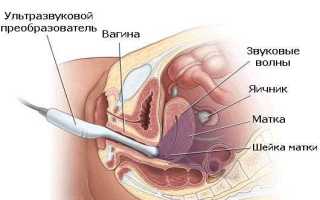 Можно ли во время месячных делать УЗИ