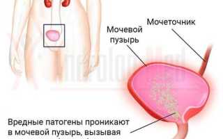Применение Цистона во время беременности