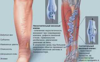 Болят ноги перед месячными