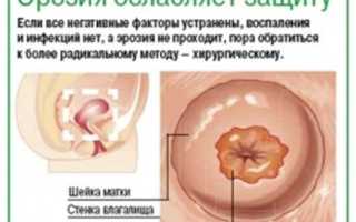Признаки при эрозии шейки матки